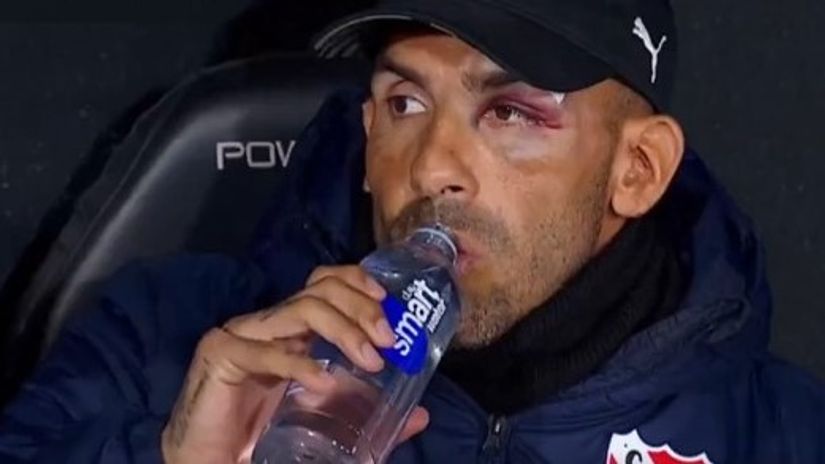 Carlitos last night with visible injuries on his left eye (©Screenshot)