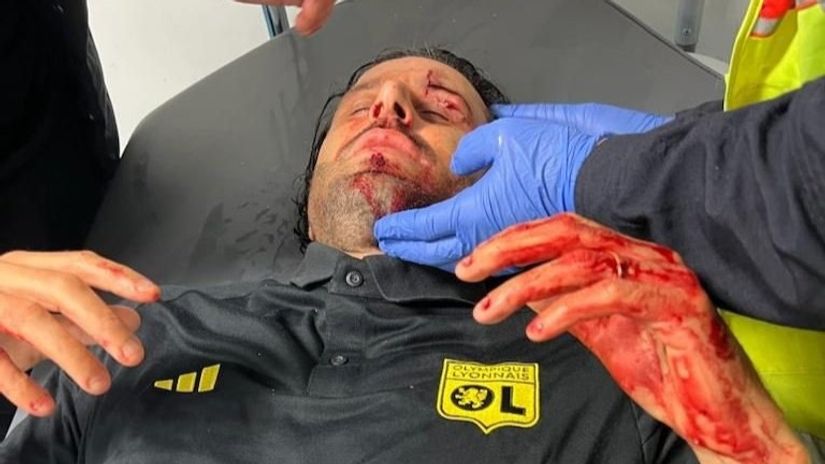 A scandal in France: Lyon's coach hurt with a stone thrown by Marseille fans