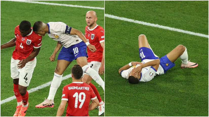 No need to raise the alarm - Mbappe making jokes about his broken nose