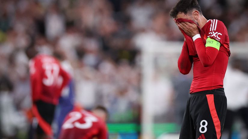 Time to suffer: Manchester lost 90 million and it will get worse