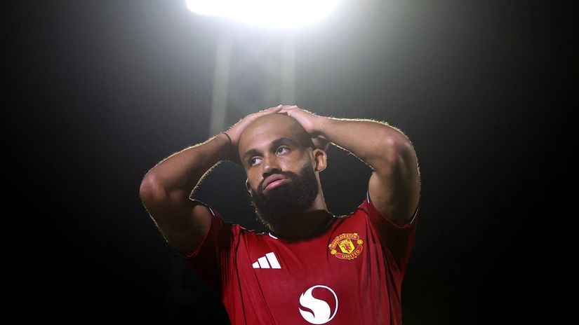 Bald vs. Bushy - for a better Manchester United