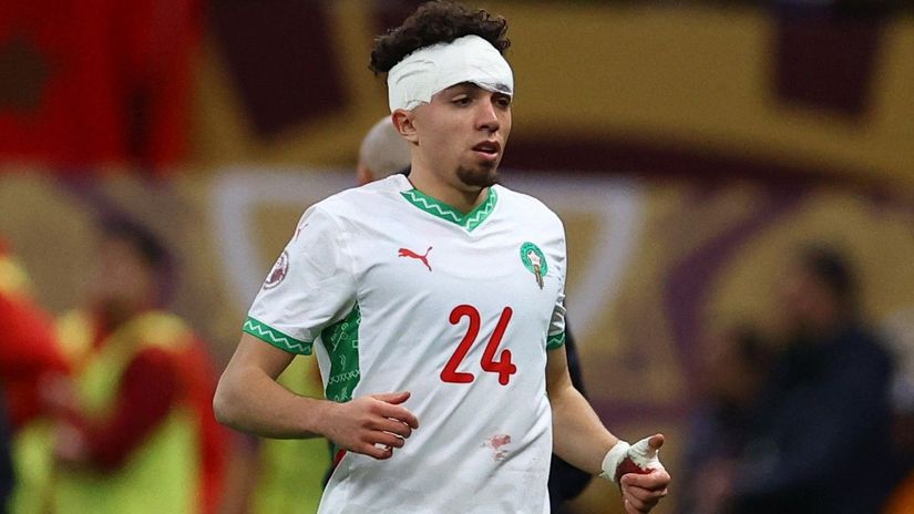 El Aynaoui during the 2025 AFCON final with his head wrapped in bandages (©Reuters/Siphiwe Sibeko/Gallo Images)